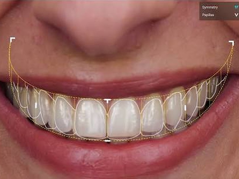 Design do Sorriso Digital (SmileCloud)